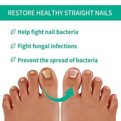 Fast Nail Fungus Treatment Serum | Nail Repair Essence for Fingernails & Toenails | Natural Nail Care Formula